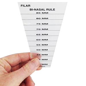 Filar Binasal Rule